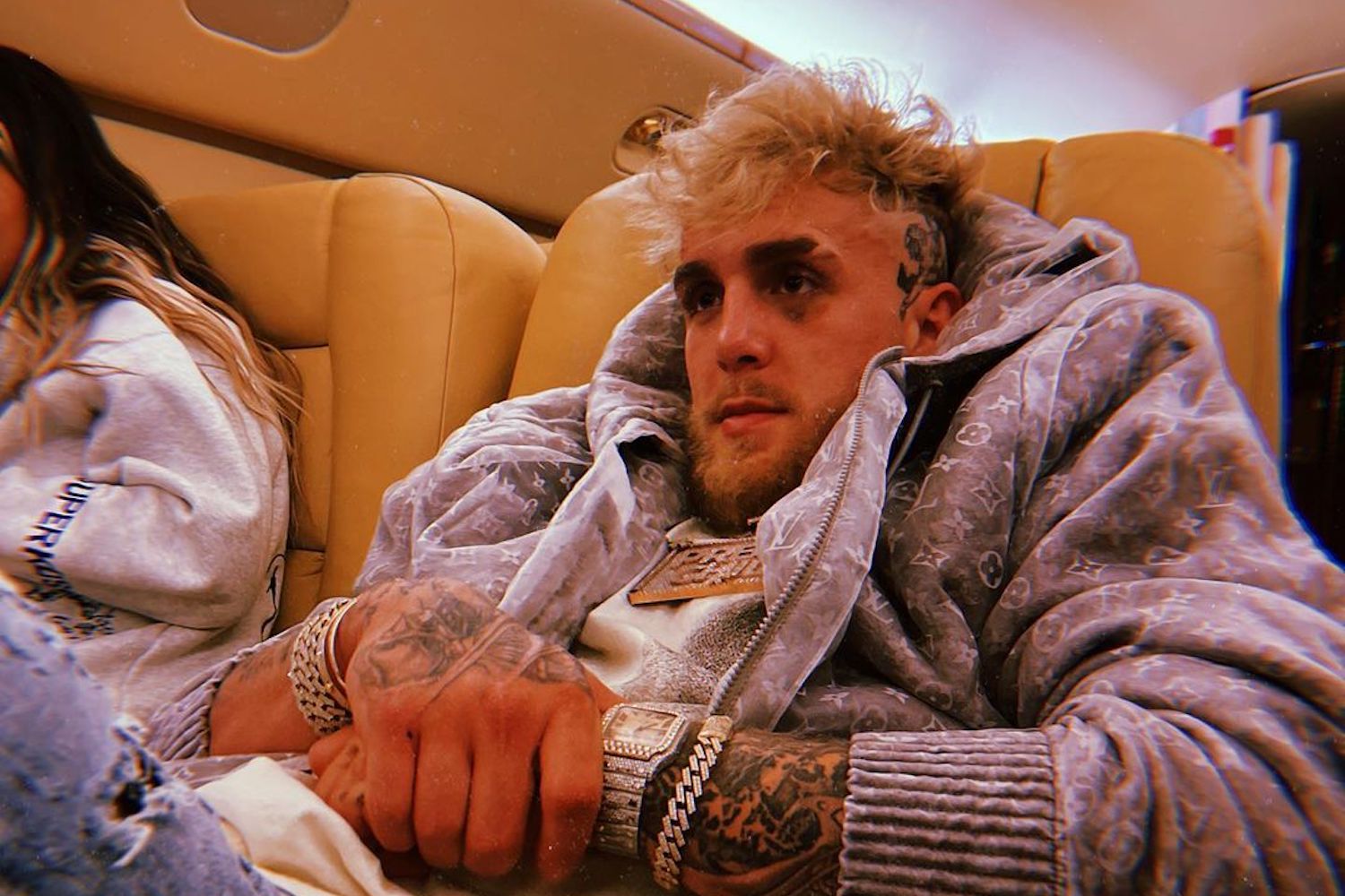 Jake Paul Takes His First Professional Loss On The Wrist