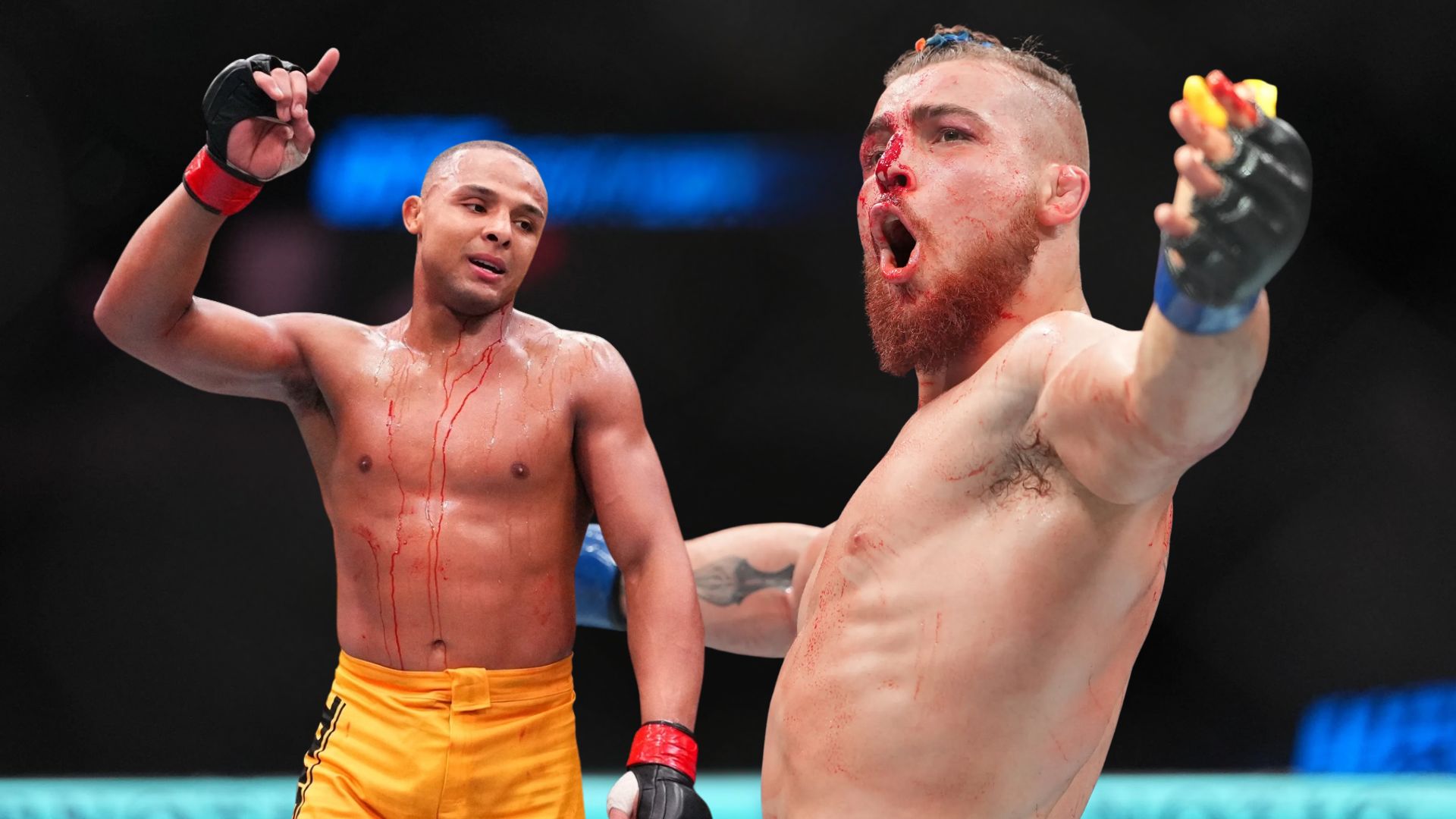 UFC Doctor’s ,000 Audemars Piguet Watch Steals Show